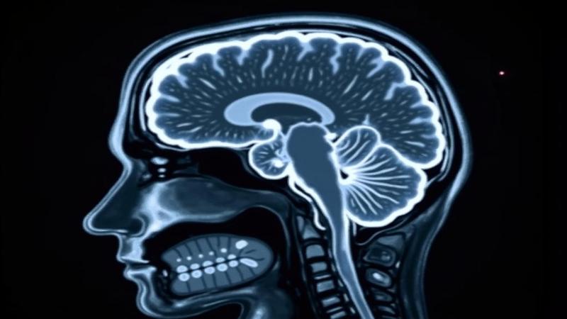 MRI brain scan with a suspicious shadow peeking from behind a fold; researchers circle it like detectives at a chalk outline.